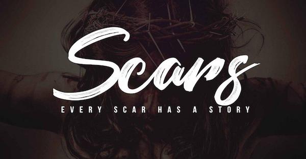 Scars Tell A Story
